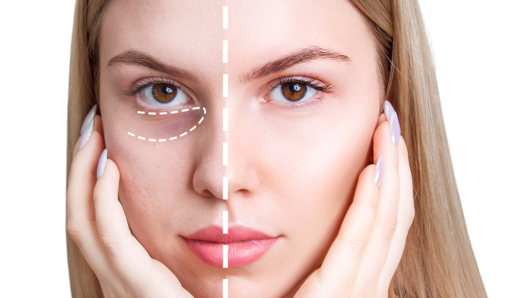 Koyu Halkalar ve Torbalanmalar: Göz Çevresi Anatomisine Uygun Aktif İçerik Seçimi