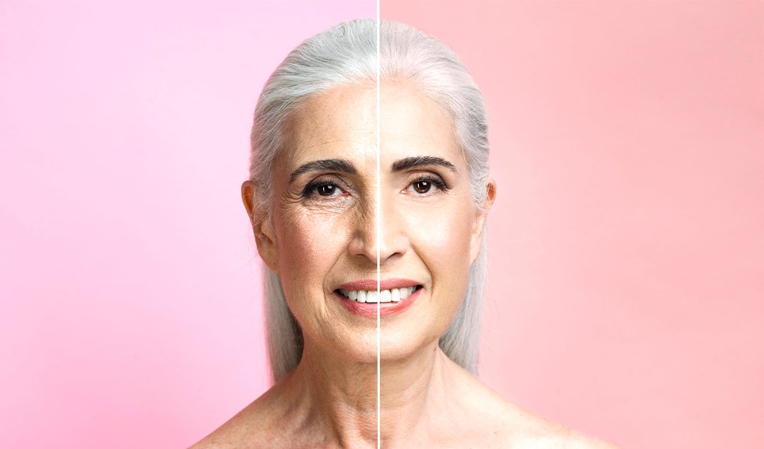Hyaluronik Asit: Yaşlanmanın Önlenmesindeki Yeni Mucize - Mila Care